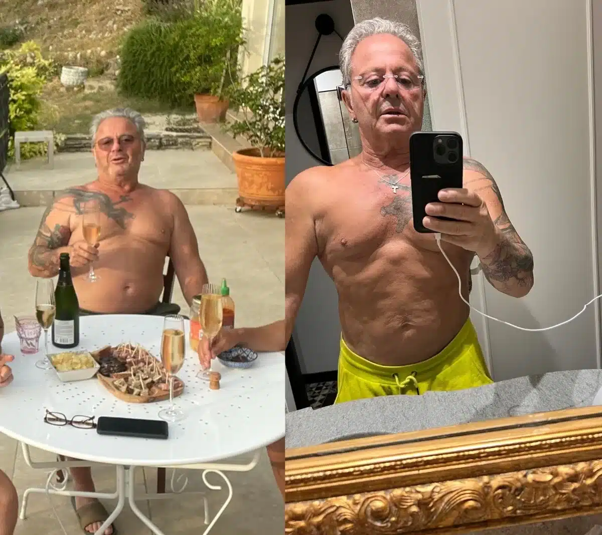 Patrice C., 65 ans, avant et après